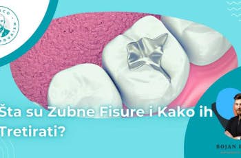 Zubne Fisure: Sta su i Kako ih Tretirati? marco dental tourism