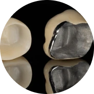 <a href='/en/services/crowns/metalceramic-crowns'>Metal-Ceramic Crowns</a>