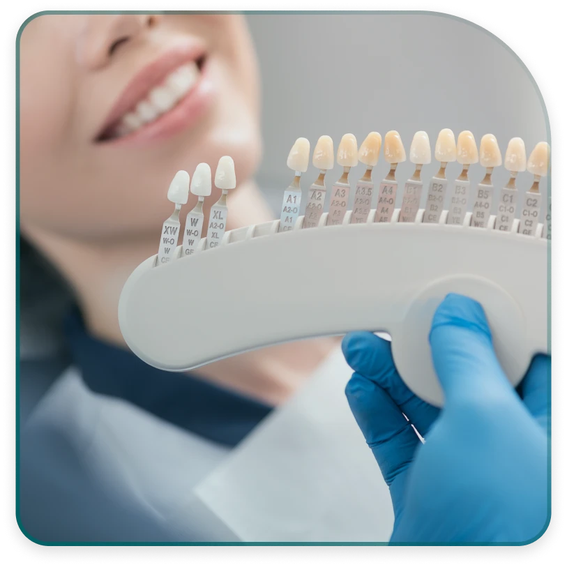 Dental veneers - materials from which they are made