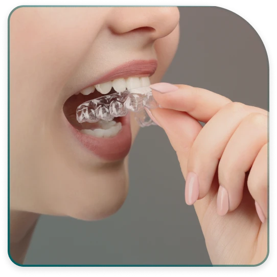 The process of making foils for teeth