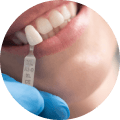 Dental Crowns Price image