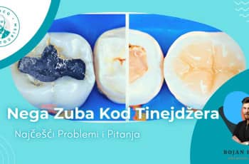 Plombiranje zuba: sta je plombiranje i kada je potrebno? marco dental tourism