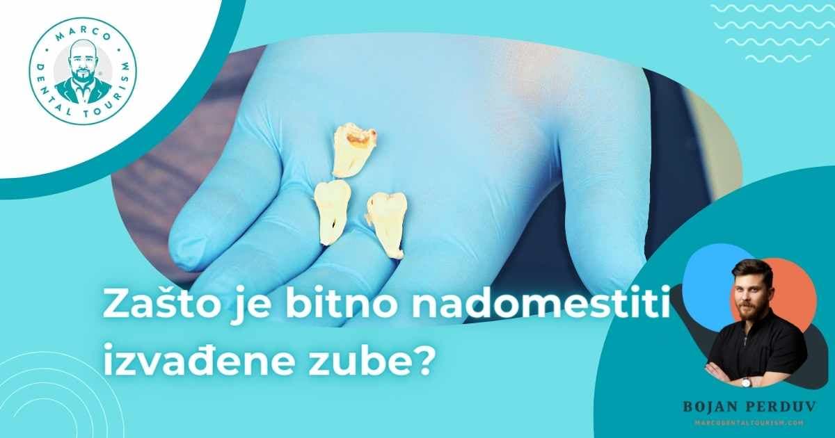 Zasto je bitno nadomestiti izvadjene zube?