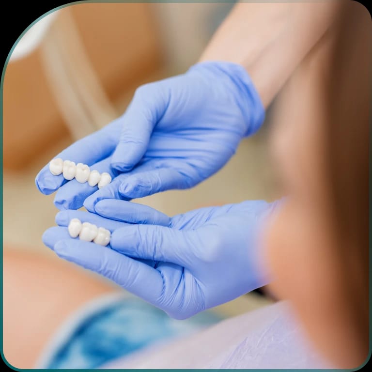 What is a crown on a tooth?