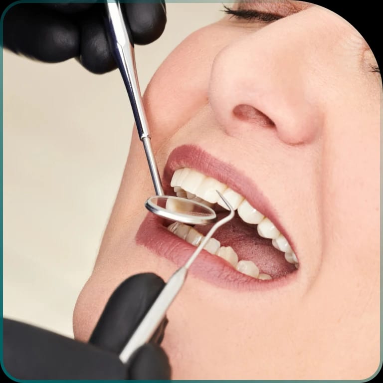 Installation of dental implants - how are dental implants installed?