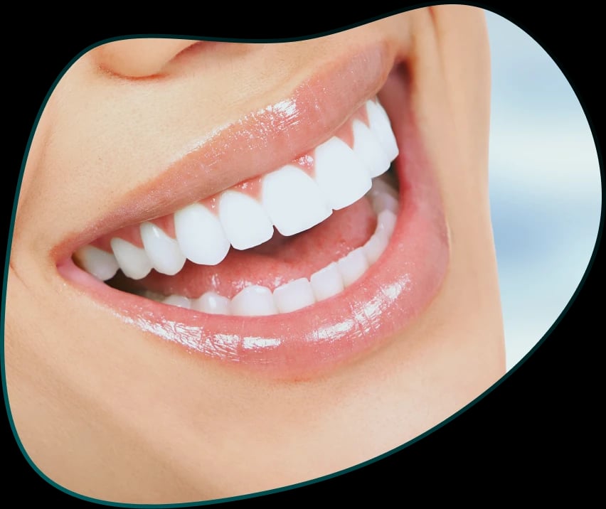 Close-up of a person before and after a Hollywood Smile aesthetic dental service — a dazzling smile transformation