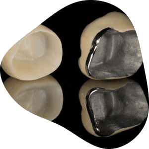 Ceramic Crowns