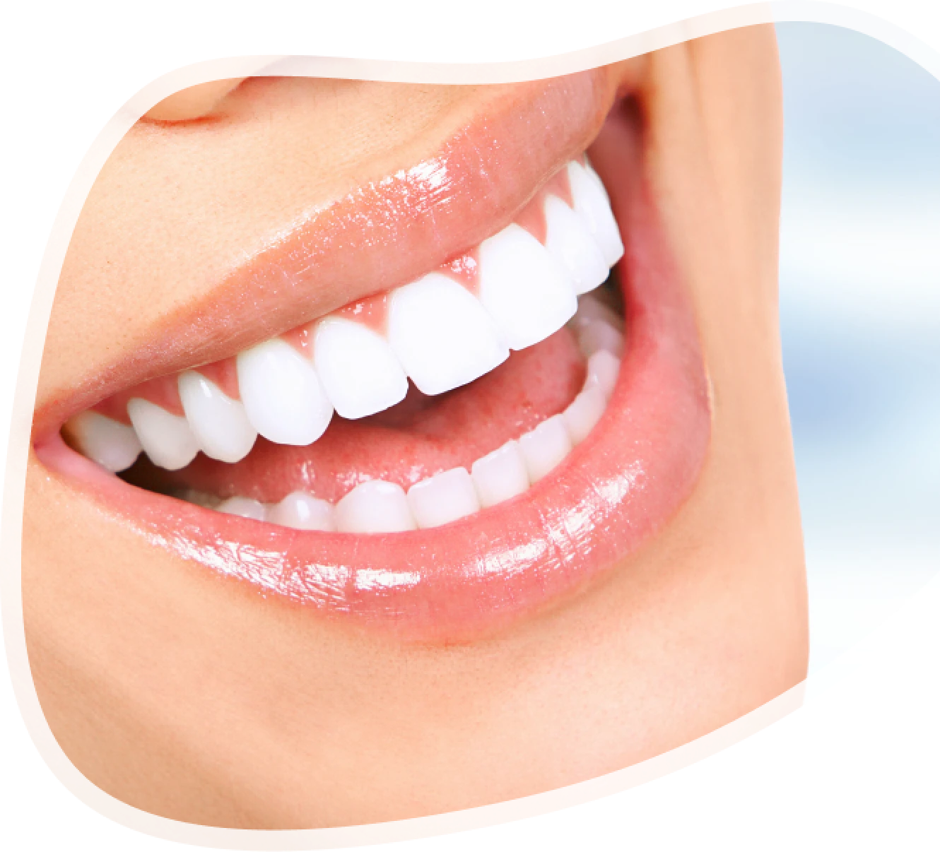 Osoba izbliza Pre i Posle nakon Hollywood smile estetičke stomatološke usluge - holivudski osmeh za blistav osmeh