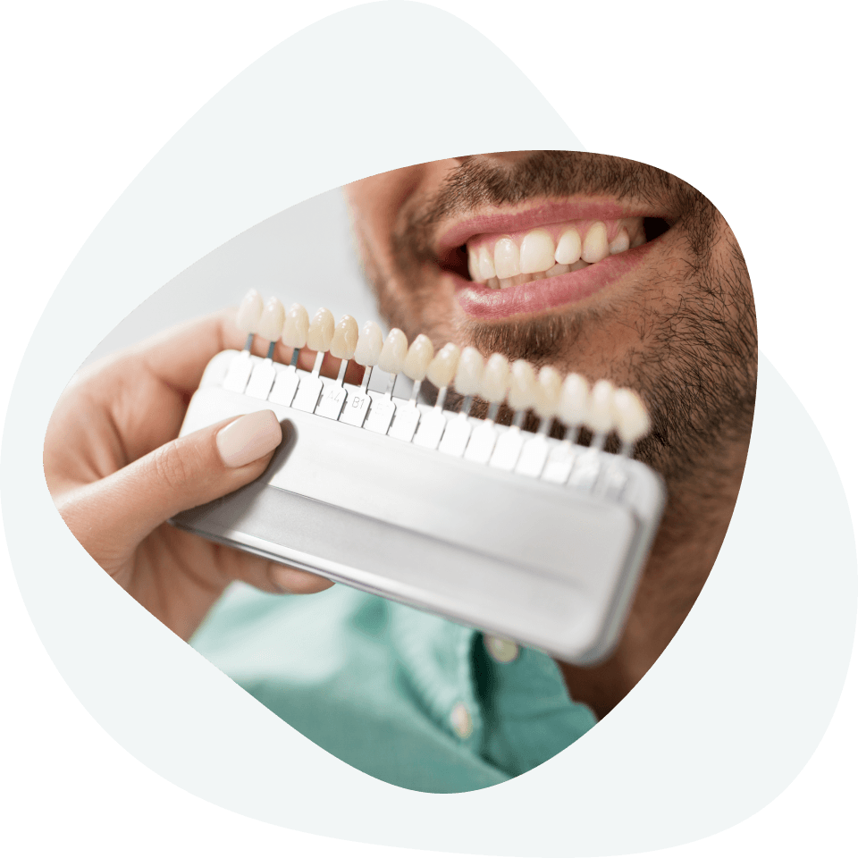 Dental veneers - materials from which they are made