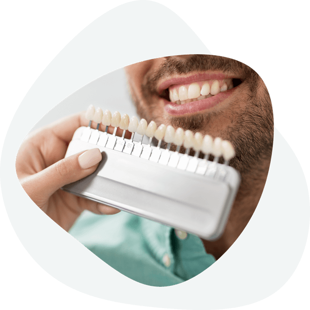 Dental veneers - materials from which they are made