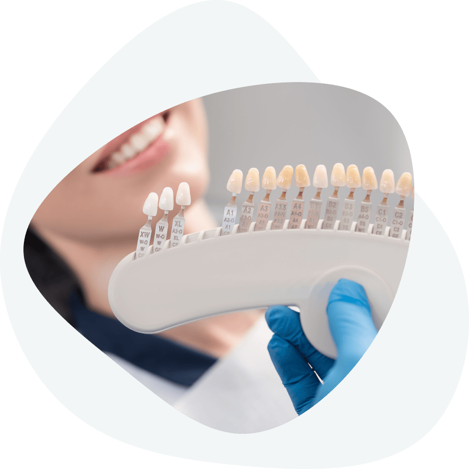 What does the making of dental veneers look like?