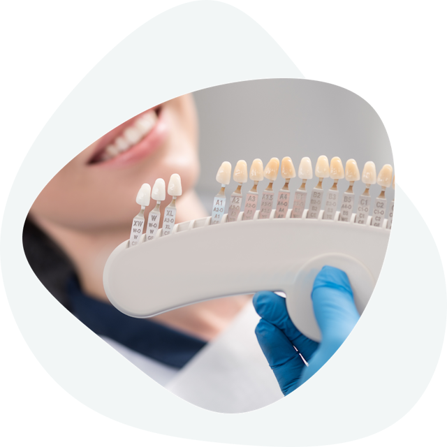 What does the making of dental veneers look like?