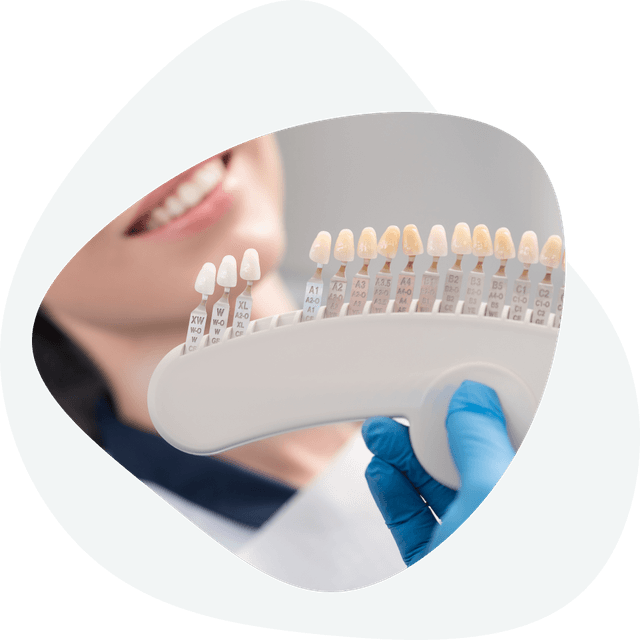 What does the making of dental veneers look like?