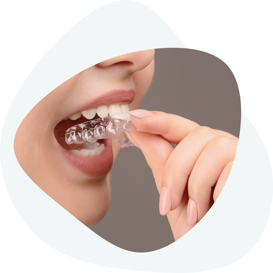 Proces pravljenja folija za zube