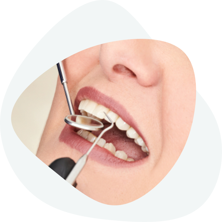 Installation of dental implants - how are dental implants installed?