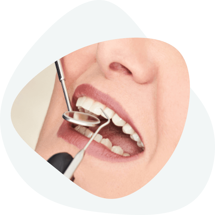 Installation of dental implants - how are dental implants installed?