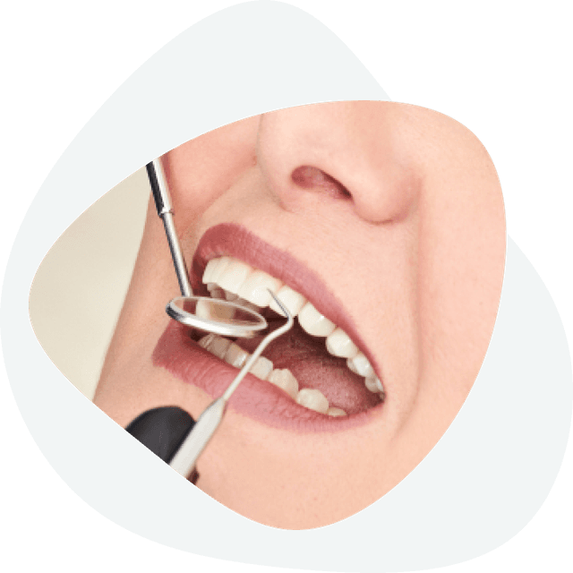 Installation of dental implants - how are dental implants installed?