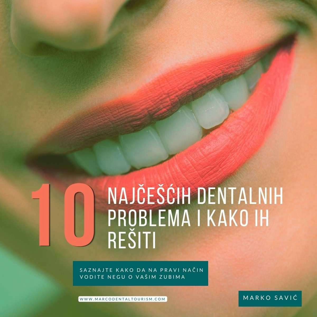 Top 10 Najcescih Dentalnih Problema i Kako ih Resiti