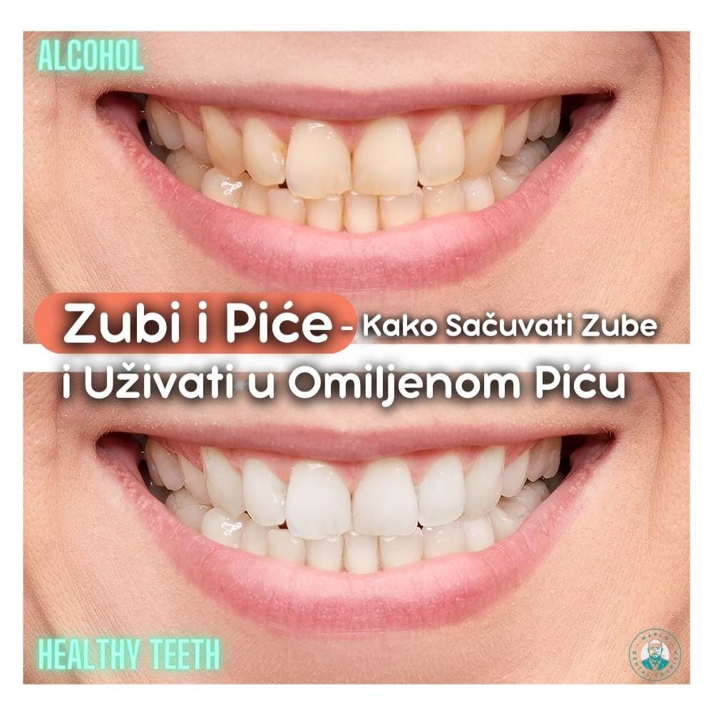 Zubi i Piće - Kako Sačuvati Zube i Uživati u Omiljenom Piću