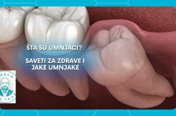 Sta su Umnjaci: Saveti Za Zdrave i Jake Umnjake marco dental tourism