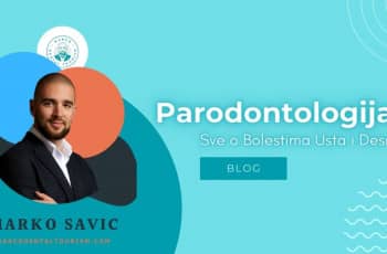 Parodontologija i Sve o Bolestima Usta i Desni marco dental tourism