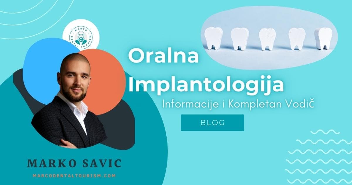 Zubni implanti - iskustva pacijenata