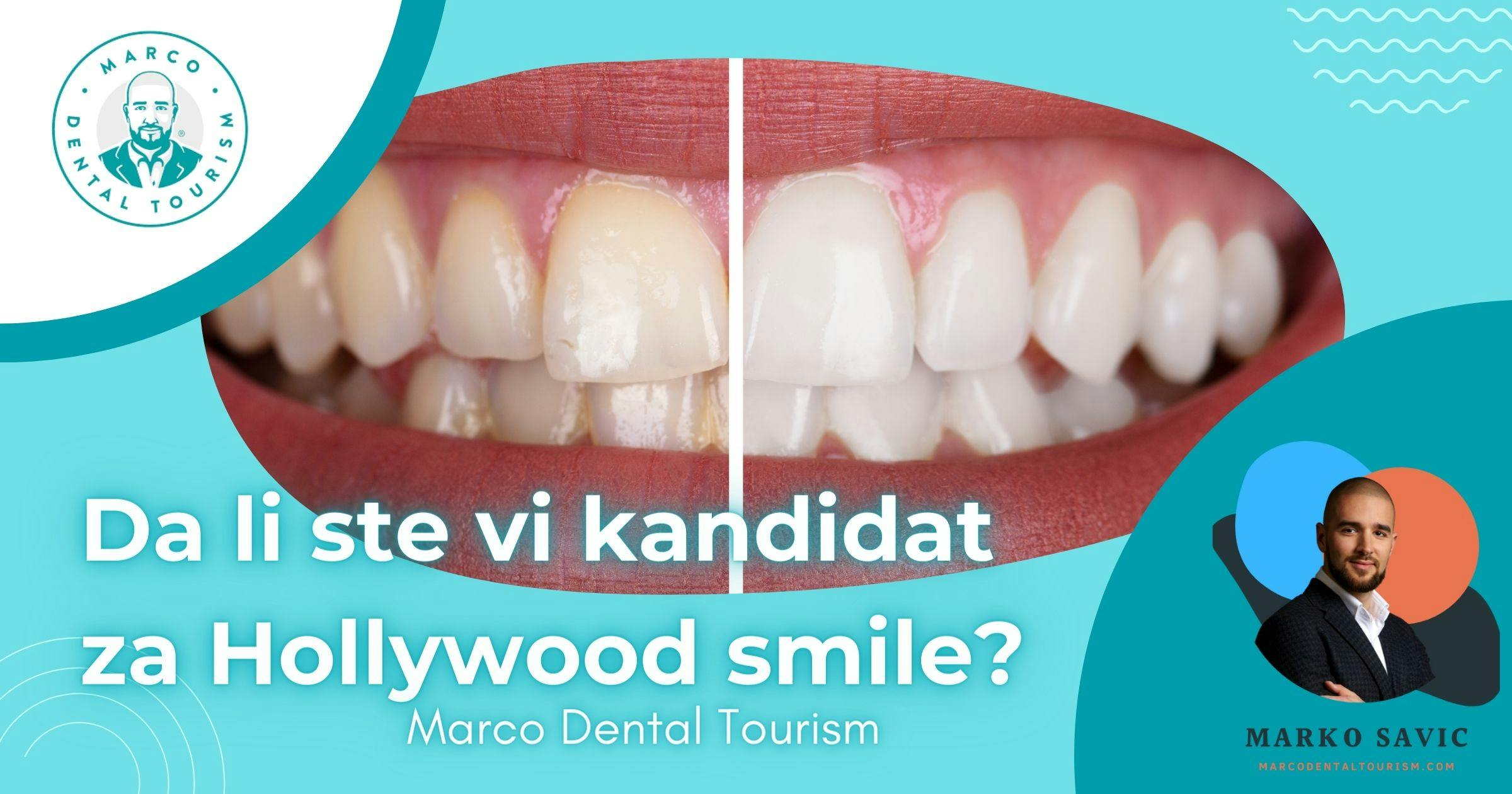 Da li ste vi kandidat za Hollywood smile - Marco Dental Tourism