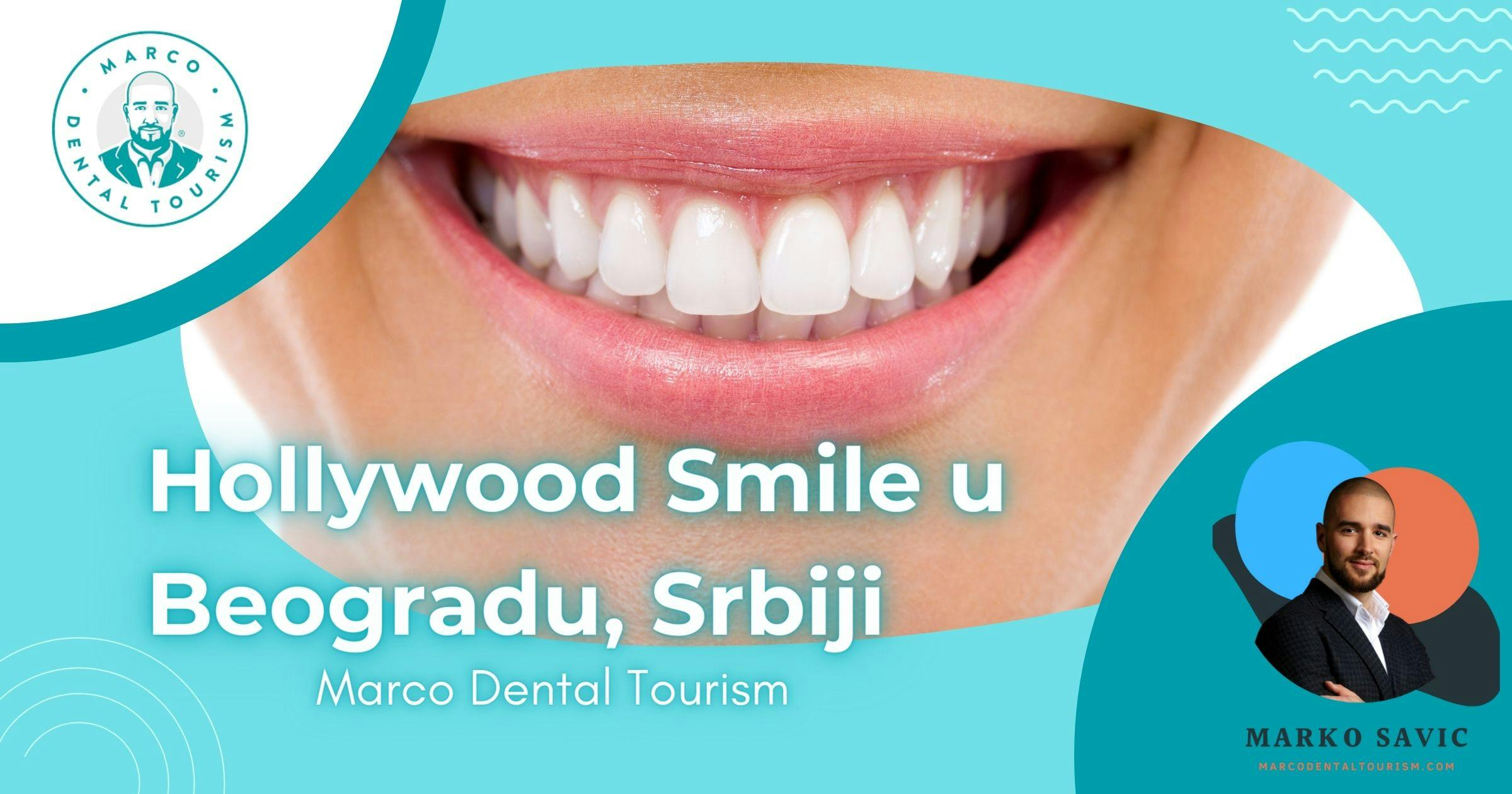 Hollywood Smile Beograd Srbija - Marco Dental Tourism