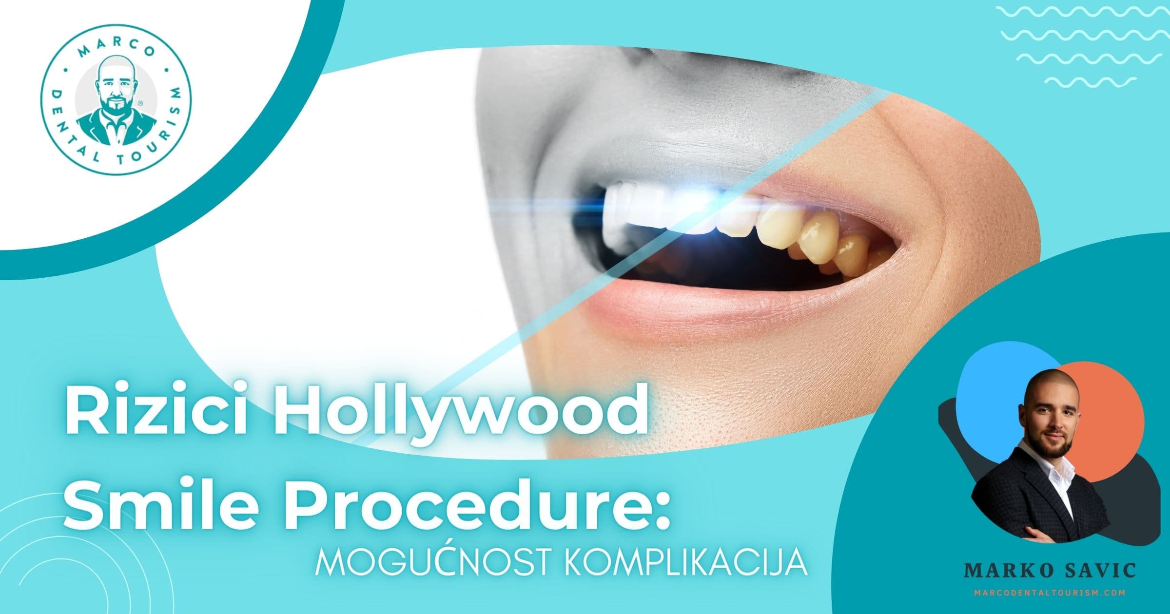 Hollywood smile rizici i komplikacije - kontrola cirkonijum krunica u ordinaciji