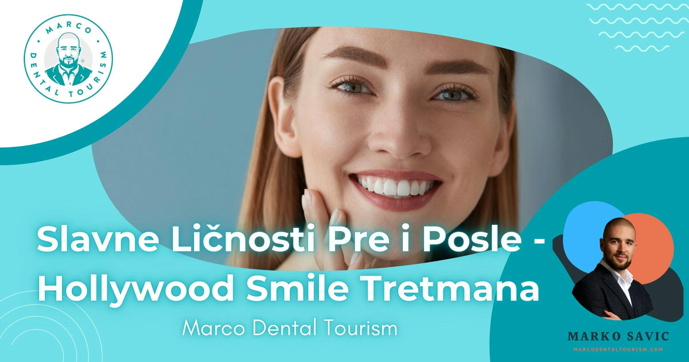 Slavne Ličnosti Pre i Posle - Hollywood Smile Tretmana - Marco Dental Tourism