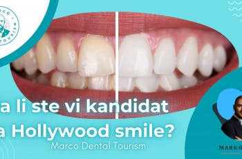Da li ste vi kandidat za Hollywood smile - Marco Dental Tourism marco dental tourism