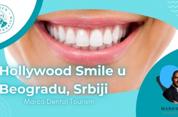 Hollywood Smile Beograd Srbija - Marco Dental Tourism marco dental tourism