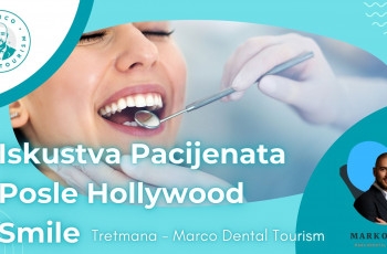 Iskustva Pacijenata Posle Hollywood Smile Tretmana - Marco Dental Tourism marco dental tourism