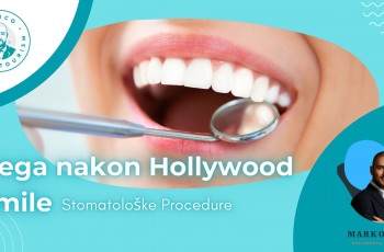 Nega nakon Hollywood Smile Stomatološke Procedure - Marco Dental Tourism marco dental tourism