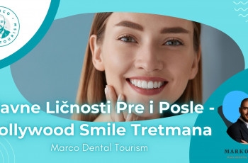 Slavne Ličnosti Pre i Posle - Hollywood Smile Tretmana - Marco Dental Tourism marco dental tourism