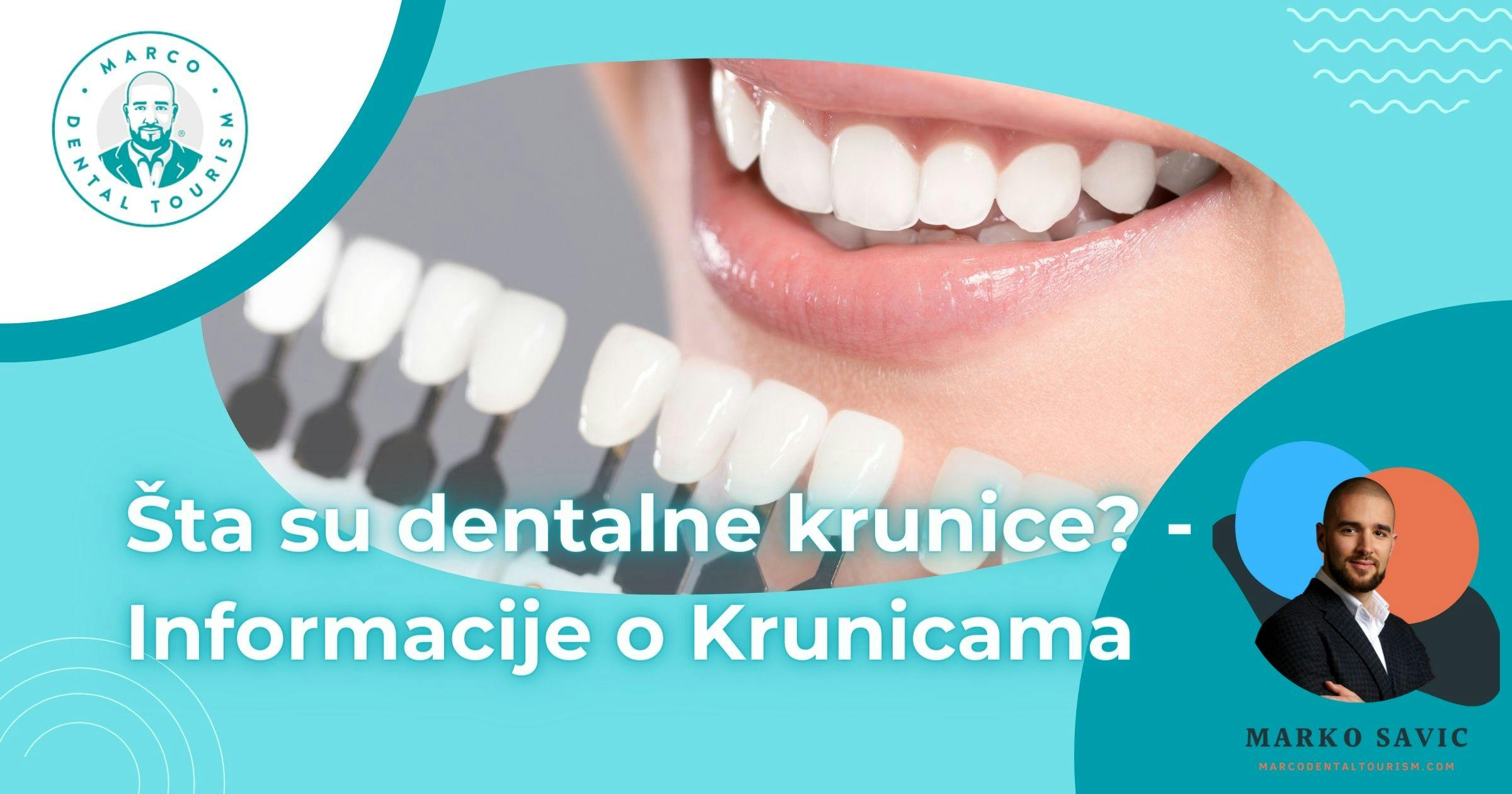 Sta su dentalne krunice - Informacije o Krunicama