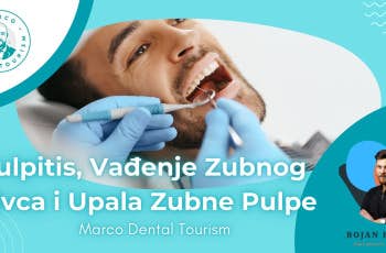Šta je Pulpitis marco dental tourism