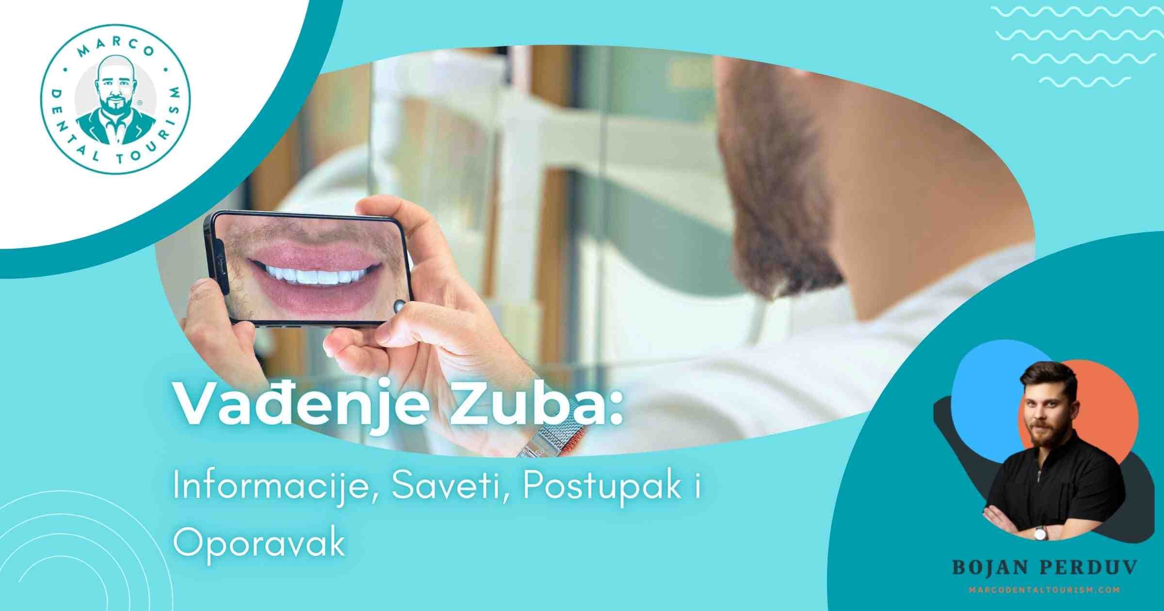 Tooth Extraction