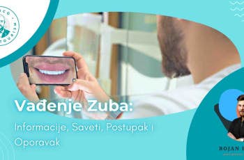 Vadjenje Zuba: Saveti, Postupak i Oporavak marco dental tourism