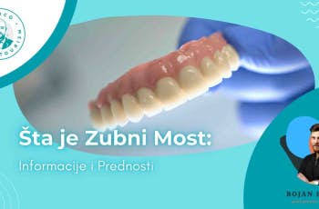 Šta je Zubni Most: Informacije i Prednosti marco dental tourism