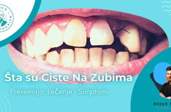 Ciste na Zubima marco dental tourism