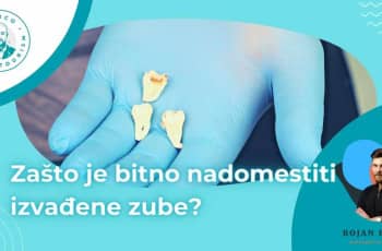 Zasto je bitno nadomestiti izvadjene zube? marco dental tourism