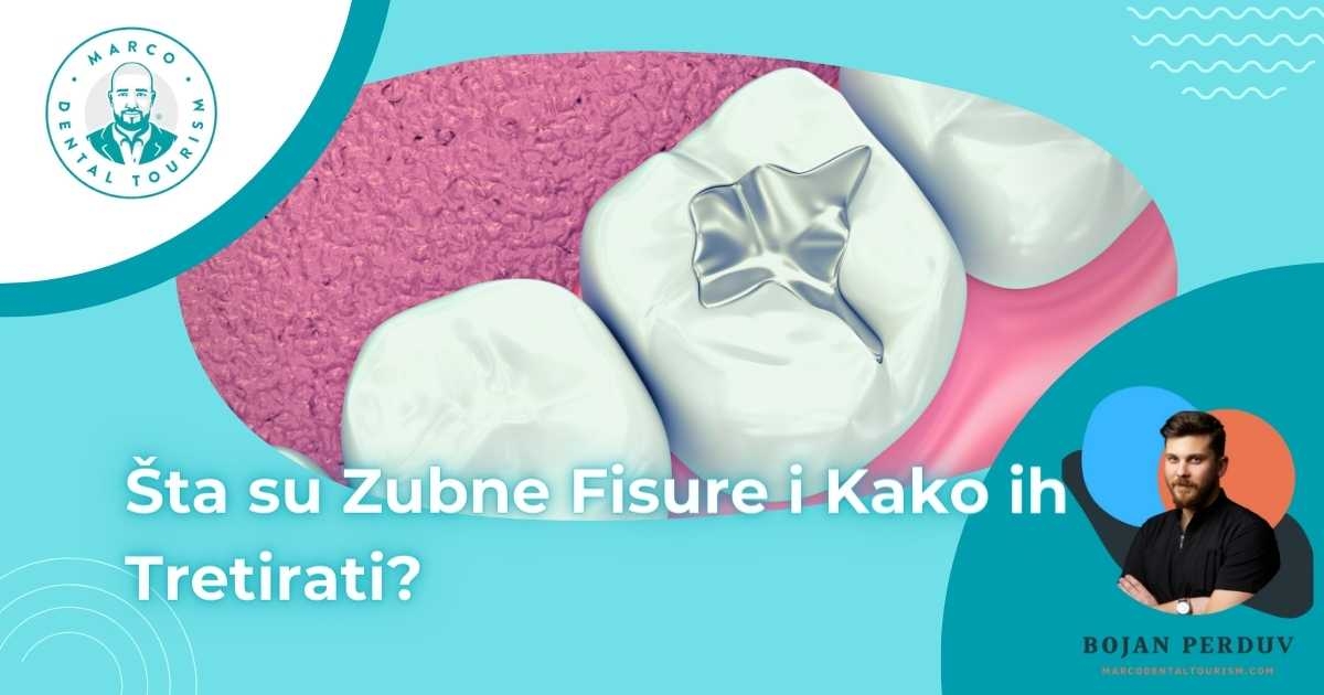 Zubne Fisure: Sta su i Kako ih Tretirati?