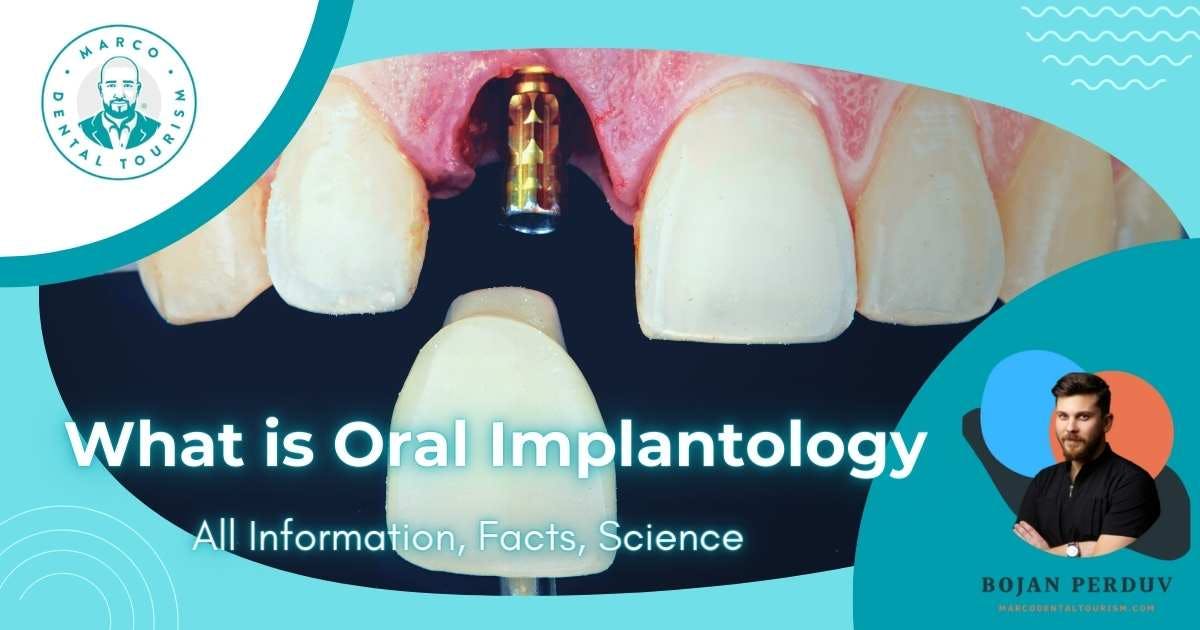 What is Oral Implantology: All Information, Facts, Science
