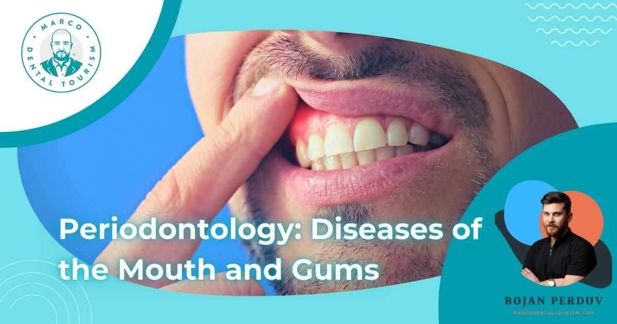 Periodontology: Diseases of the Mouth and Gums