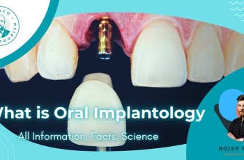 What is Oral Implantology: All Information, Facts, Science marco dental tourism
