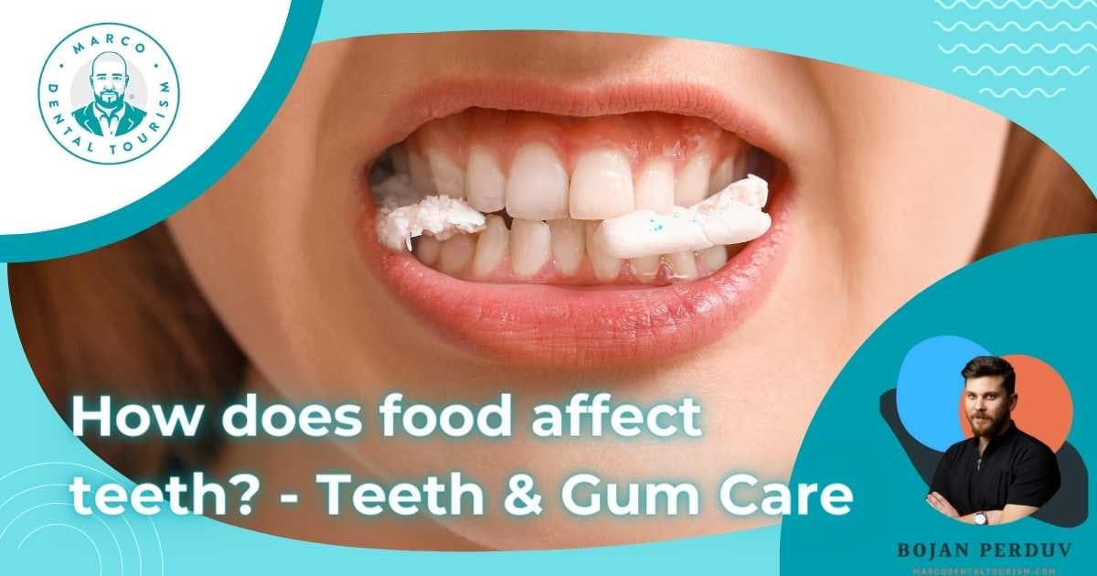 How does food affect teeth?