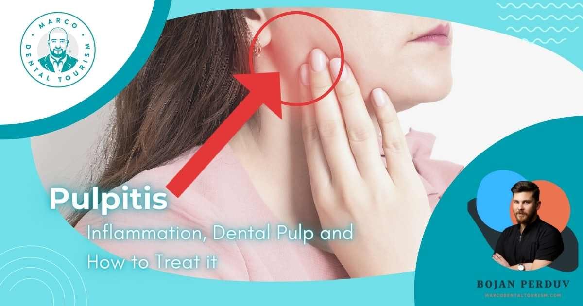 Pulpitis: Inflammation, Dental Pulp and How to Treat it