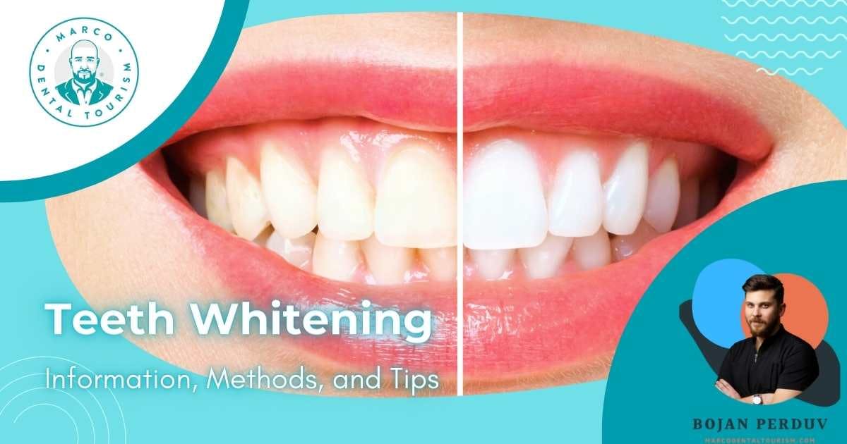 Teeth Whitening: Information, Methods, and Tips