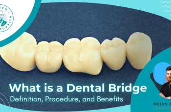 What is a Dental Bridge: Definition, Procedure, and Benefits marco dental tourism